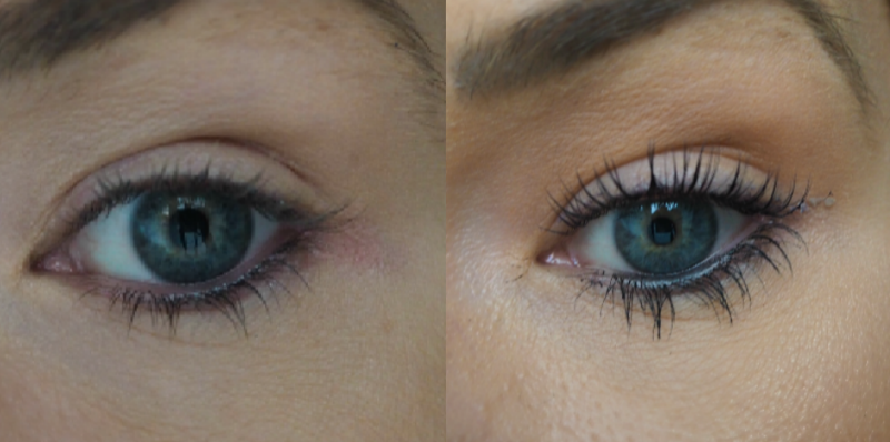 Results from LVL lash lift
